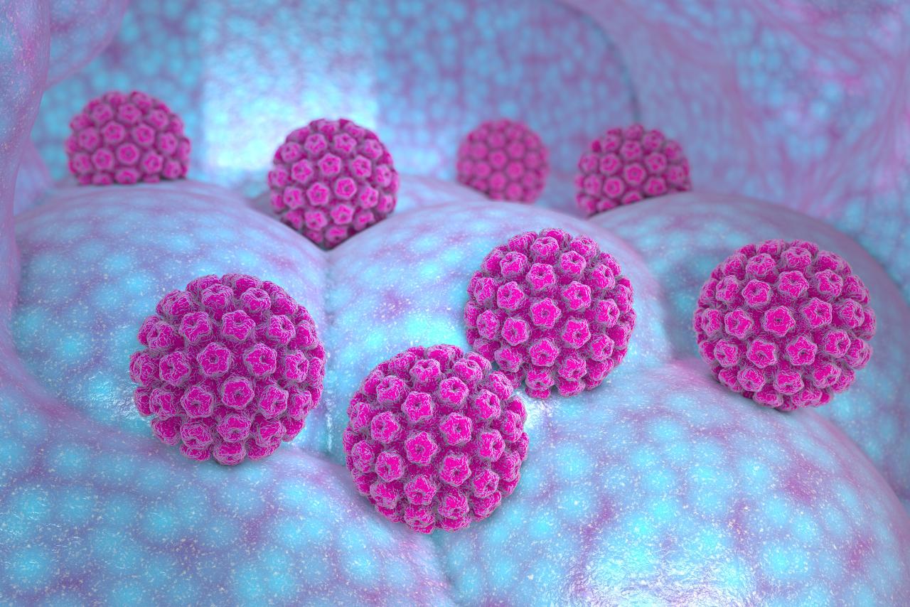 Computer render of a Human papillomavirus infection