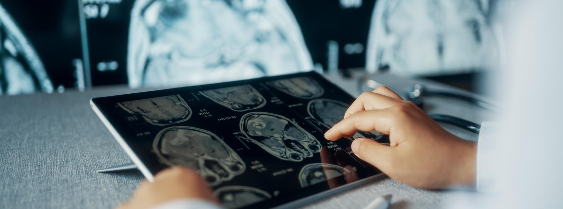 A doctor reviews an MRI on a tablet with other medical images in the background