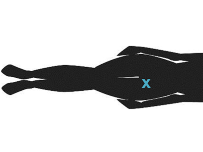 illustration showing the location on the top of the thigh on a leg for lower femoral nerve blocks